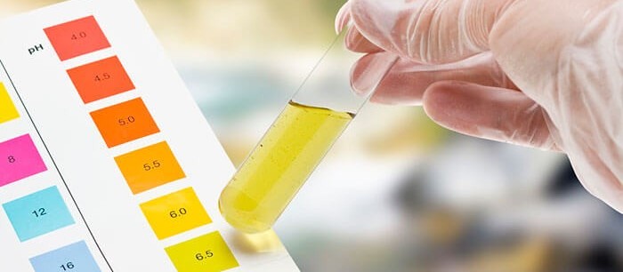 Exame de urina pode indicar sinal de insuficiência renal