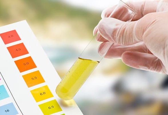 Exame de urina pode indicar sinal de insuficiência renal